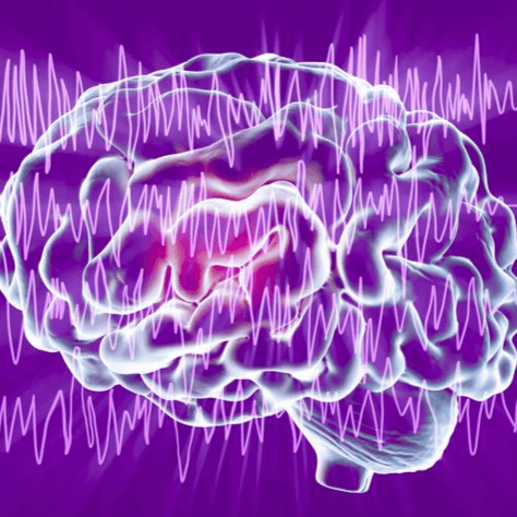All you want to know about Epilepsy ?