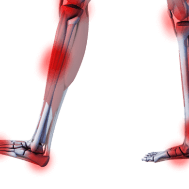 Restless Leg Syndrome (RLS) ?